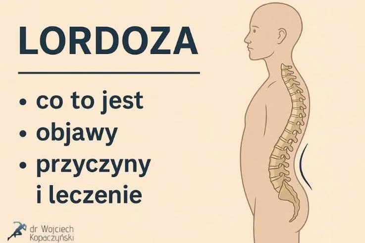Lordoza lędźwiowa